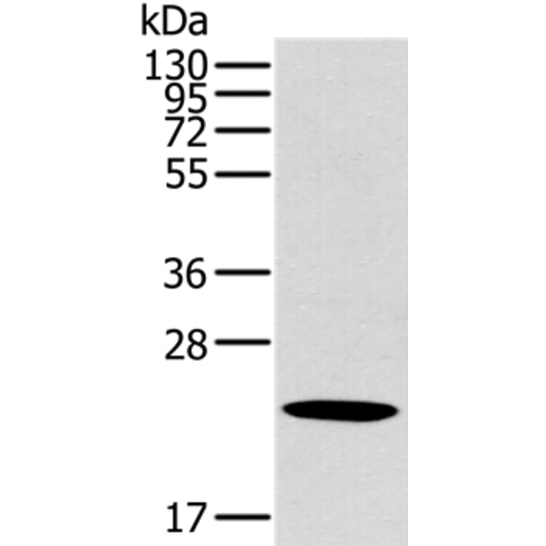 OTUB2 Antibody from Signalway Antibody (36671) - Antibodies.com