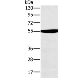 OXCT1 Antibody from Signalway Antibody (36673) - Antibodies.com