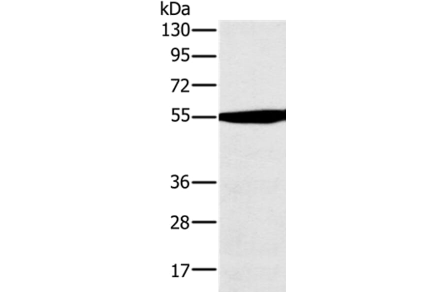 OXCT1 Antibody from Signalway Antibody (36673) - Antibodies.com