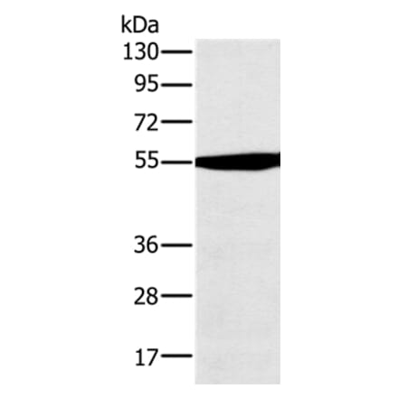 OXCT1 Antibody from Signalway Antibody (36673) - Antibodies.com