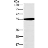 OXCT1 Antibody from Signalway Antibody (36673) - Antibodies.com