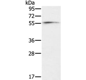 OXSR1 Antibody from Signalway Antibody (36674) - Antibodies.com