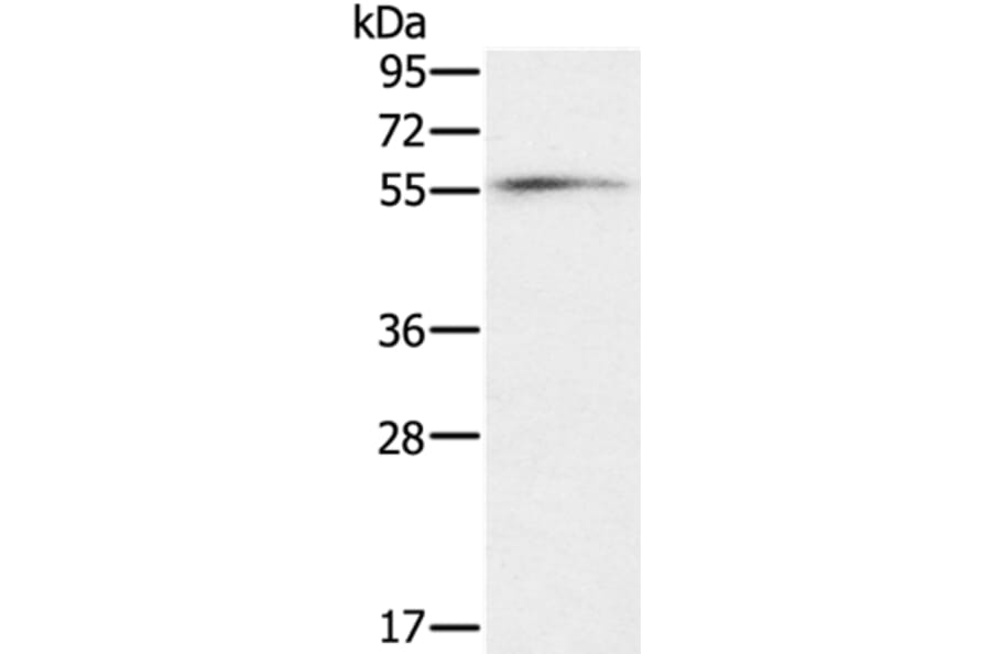 OXSR1 Antibody from Signalway Antibody (36674) - Antibodies.com