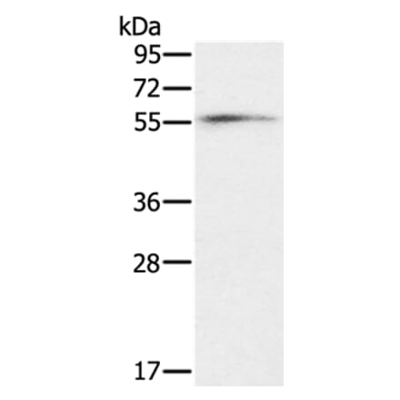 OXSR1 Antibody from Signalway Antibody (36674) - Antibodies.com