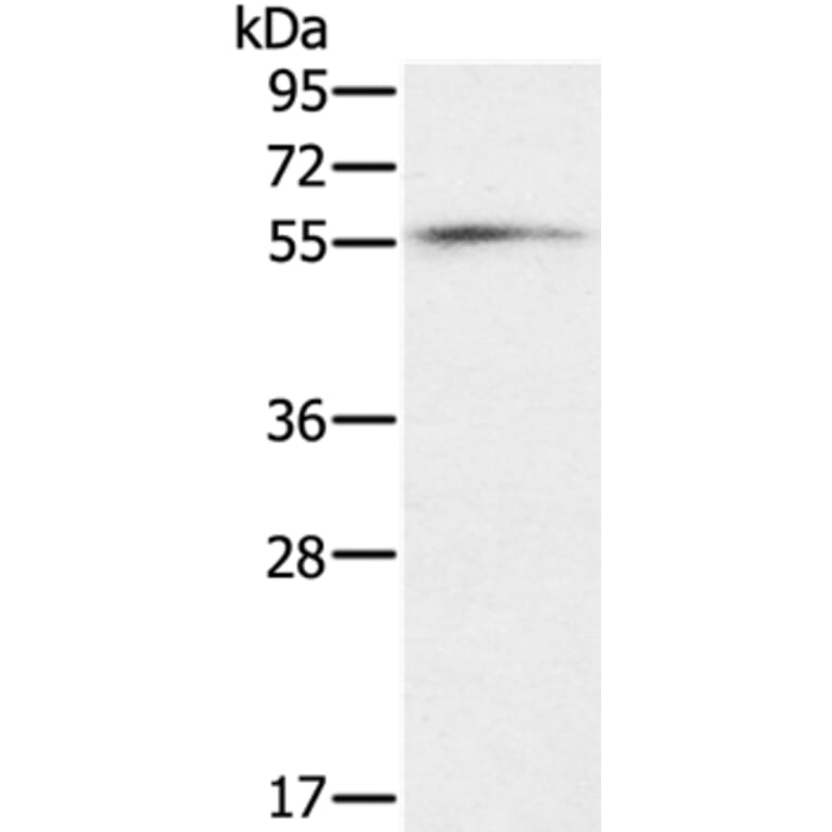 OXSR1 Antibody from Signalway Antibody (36674) - Antibodies.com