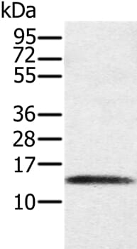 Gel: 12% SDS-PAGE Lysates (from left to right): Human placenta tissue Amount of lysate: 40ug per lane Primary antibody: 1/200 dilution Secondary antibody dilution: 1/8000 Exposure time: 3 minutes