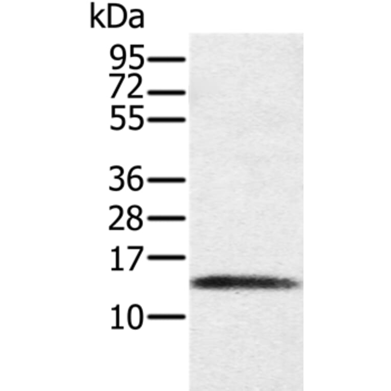 PAGE1 Antibody from Signalway Antibody (36677) - Antibodies.com
