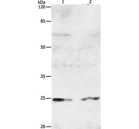 RAB8A Antibody from Signalway Antibody (36732) - Antibodies.com