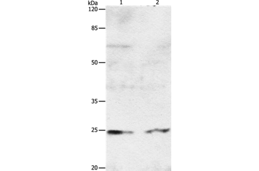 RAB8A Antibody from Signalway Antibody (36732) - Antibodies.com