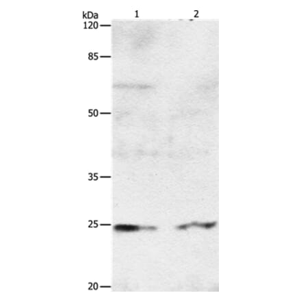 RAB8A Antibody from Signalway Antibody (36732) - Antibodies.com