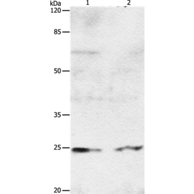 RAB8A Antibody from Signalway Antibody (36732) - Antibodies.com