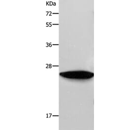 RAB38 Antibody from Signalway Antibody (36736) - Antibodies.com