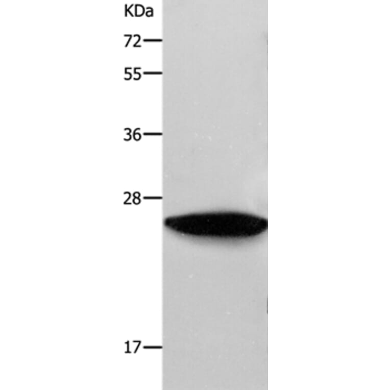 RAB38 Antibody from Signalway Antibody (36736) - Antibodies.com