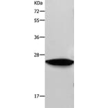 RAB38 Antibody from Signalway Antibody (36736) - Antibodies.com