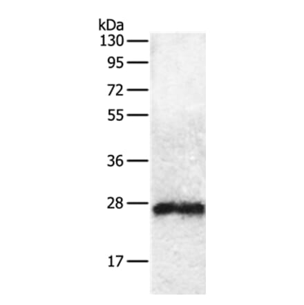 RAB5C Antibody from Signalway Antibody (36745) - Antibodies.com