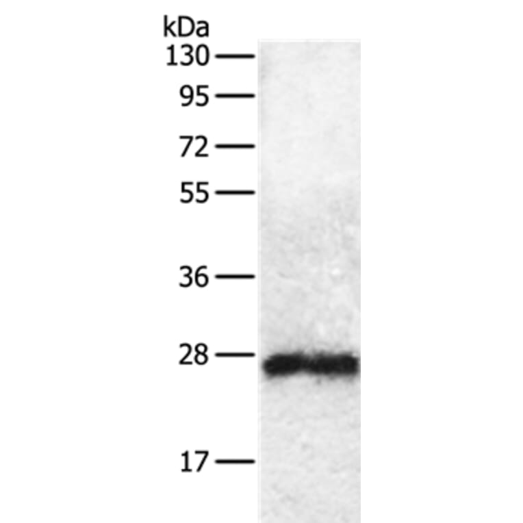 RAB5C Antibody from Signalway Antibody (36745) - Antibodies.com