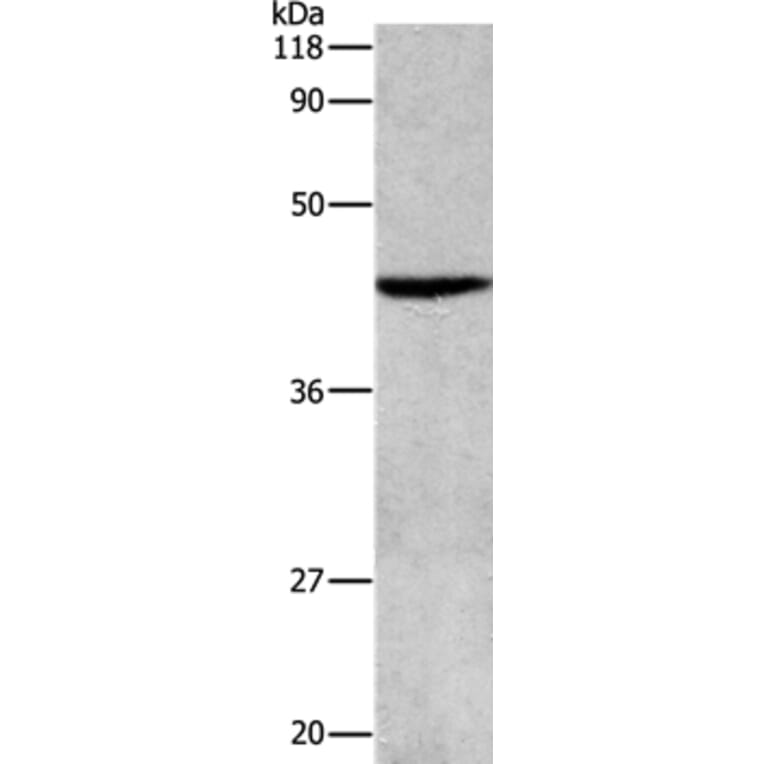 APG4B Antibody from Signalway Antibody (36757) - Antibodies.com