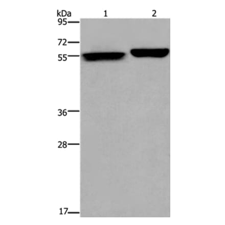 BECN1 Antibody from Signalway Antibody (36768) - Antibodies.com