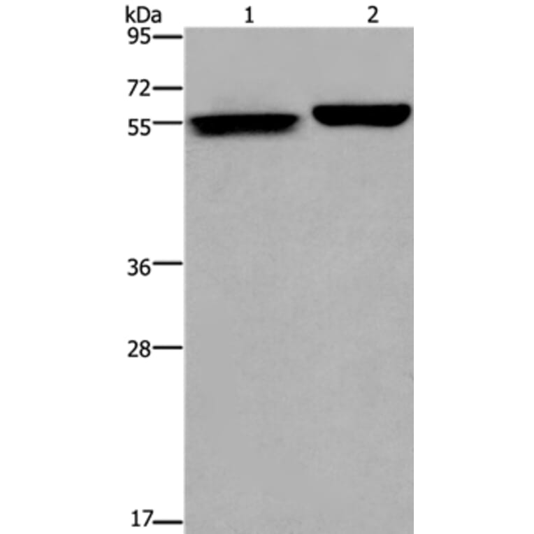 BECN1 Antibody from Signalway Antibody (36768) - Antibodies.com