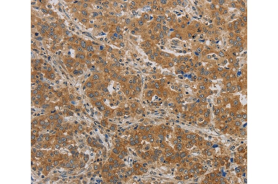 Immunohistochemistry - BECN1 Antibody from Signalway Antibody (36768) - Antibodies.com
