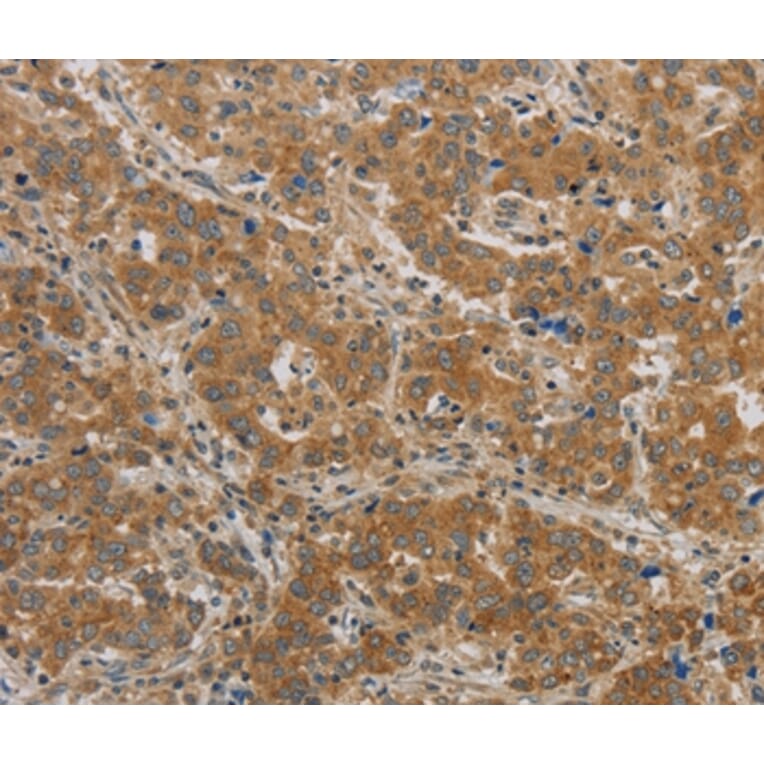 Immunohistochemistry - BECN1 Antibody from Signalway Antibody (36768) - Antibodies.com