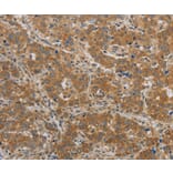 Immunohistochemistry - BECN1 Antibody from Signalway Antibody (36768) - Antibodies.com