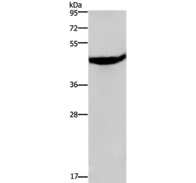CXCR2 Antibody from Signalway Antibody (36813) - Antibodies.com