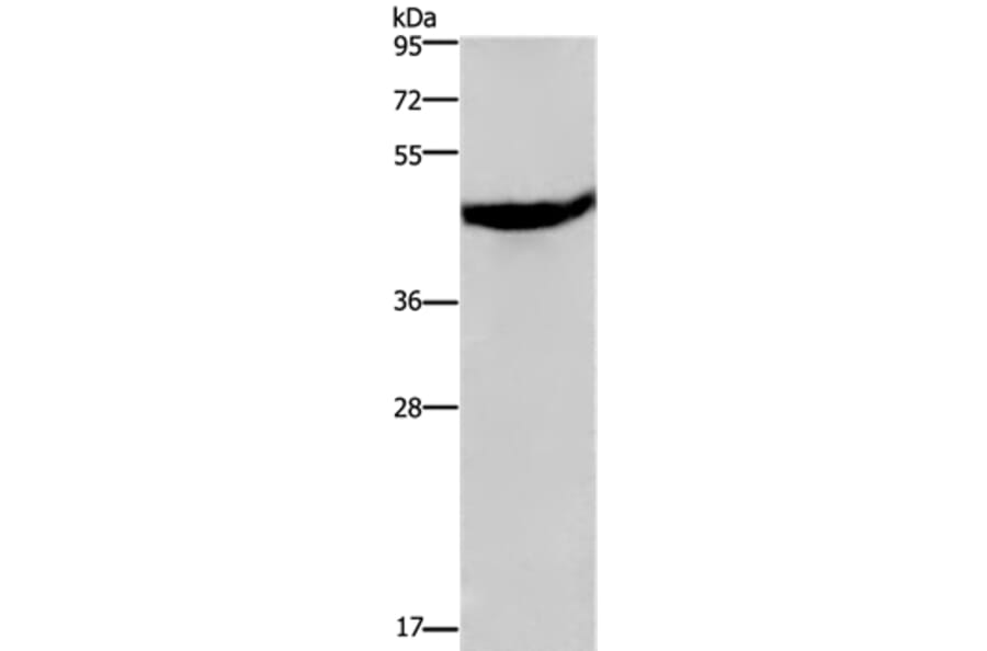 CXCR2 Antibody from Signalway Antibody (36813) - Antibodies.com