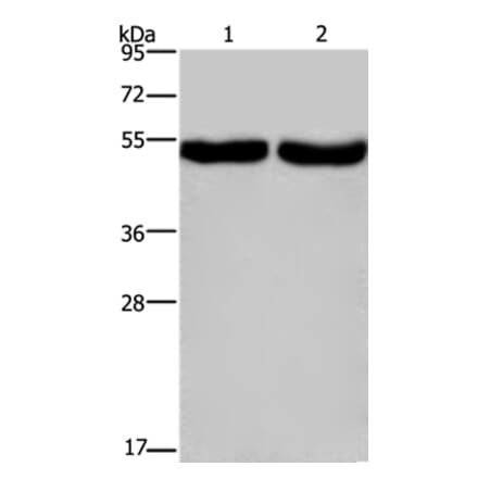CXCR1 Antibody from Signalway Antibody (36814) - Antibodies.com