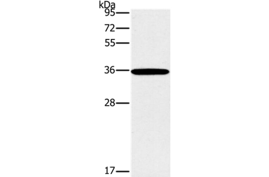 FOSL1 Antibody from Signalway Antibody (36857) - Antibodies.com