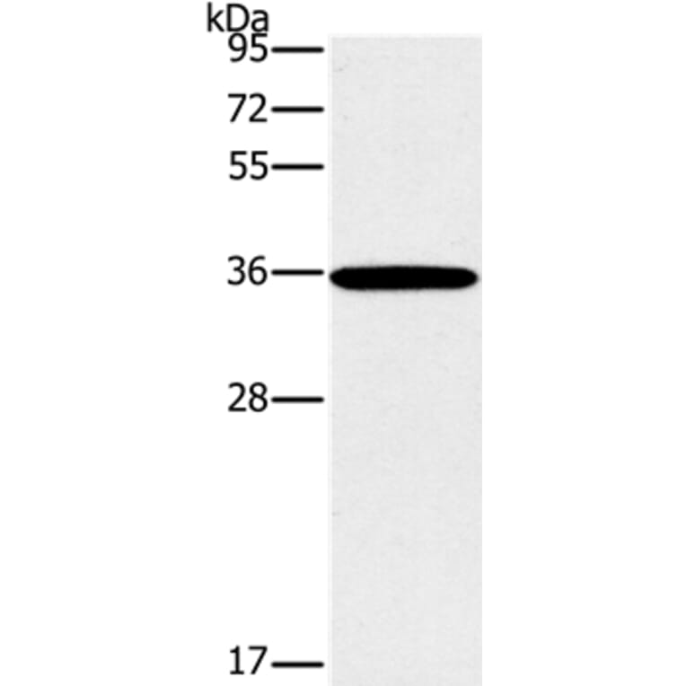 FOSL1 Antibody from Signalway Antibody (36857) - Antibodies.com