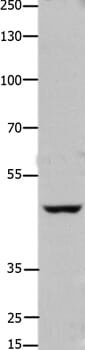 Gel: 8% SDS-PAGE Lysate: 40ug Hela cell Primary antibody: 1/450 dilution Secondary antibody dilution: 1/8000 Exposure time: 1 minute