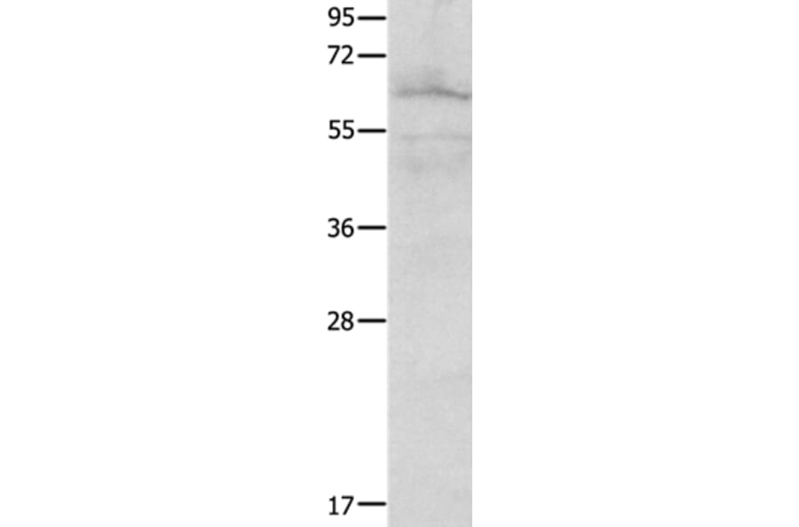 FOXJ2 Antibody from Signalway Antibody (36867) - Antibodies.com