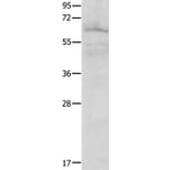 FOXJ2 Antibody from Signalway Antibody (36867) - Antibodies.com