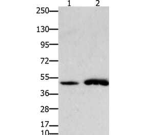 FOXL2 Antibody from Signalway Antibody (36868) - Antibodies.com
