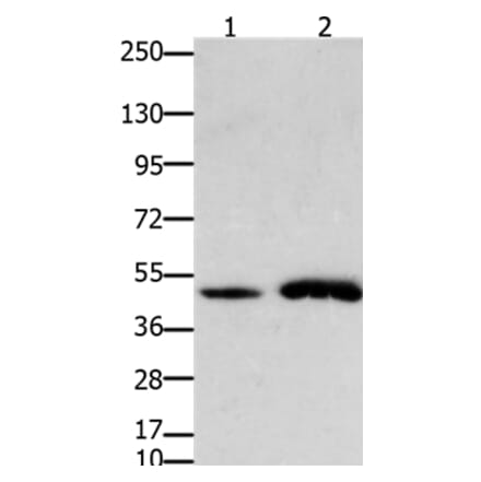 FOXL2 Antibody from Signalway Antibody (36868) - Antibodies.com