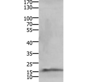 CMTM5 Antibody from Signalway Antibody (36885) - Antibodies.com