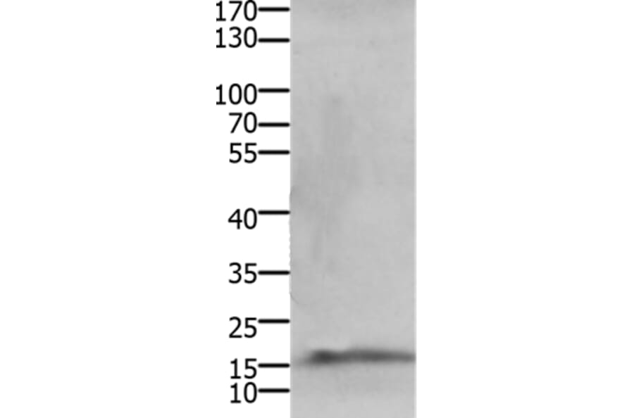 CMTM5 Antibody from Signalway Antibody (36885) - Antibodies.com