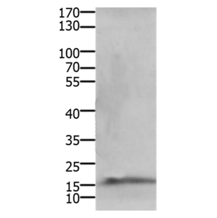 CMTM5 Antibody from Signalway Antibody (36885) - Antibodies.com