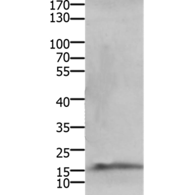 CMTM5 Antibody from Signalway Antibody (36885) - Antibodies.com
