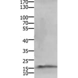 CMTM5 Antibody from Signalway Antibody (36885) - Antibodies.com