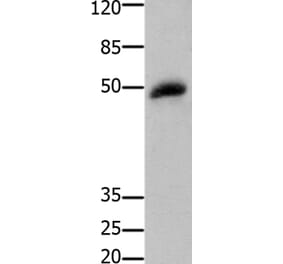 GSK3B Antibody from Signalway Antibody (36918) - Antibodies.com