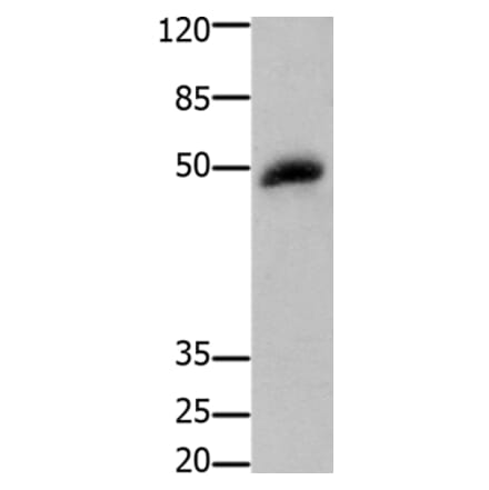 GSK3B Antibody from Signalway Antibody (36918) - Antibodies.com