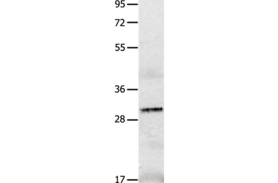 IL2RA Antibody from Signalway Antibody (36931) - Antibodies.com