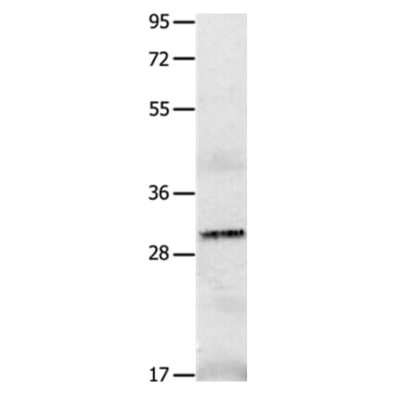 IL2RA Antibody from Signalway Antibody (36931) - Antibodies.com