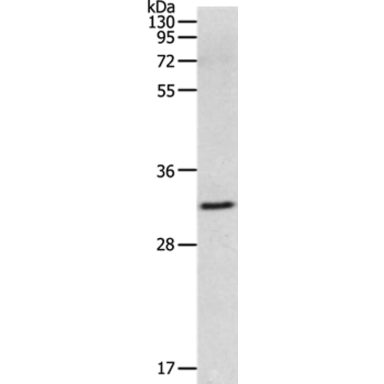 MMP26 Antibody from Signalway Antibody (36987) - Antibodies.com