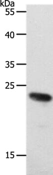 Gel: 10% SDS-PAGE Lysate: 40ug 231 cell Primary antibody: 1/650 dilution Secondary antibody dilution: 1/8000 Exposure time: 5 minutes
