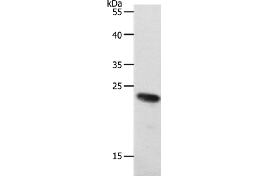 RAMP2 Antibody from Signalway Antibody (37019) - Antibodies.com