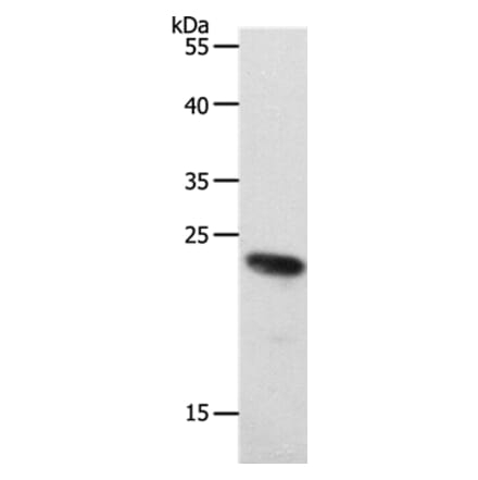 RAMP2 Antibody from Signalway Antibody (37019) - Antibodies.com