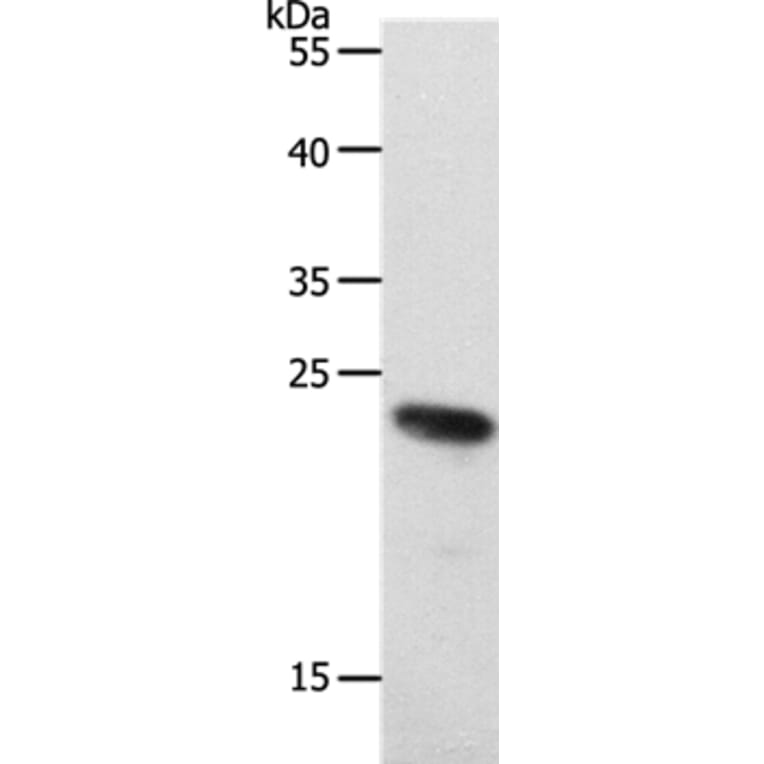 RAMP2 Antibody from Signalway Antibody (37019) - Antibodies.com